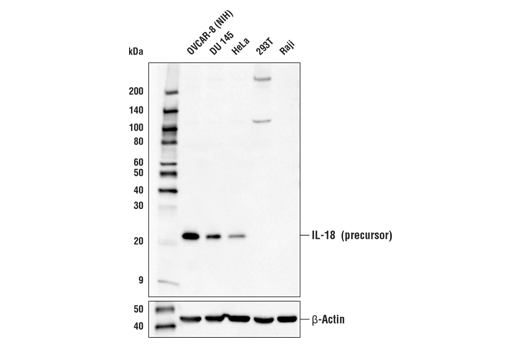 Western Blotting Image 2: IL-18 (D2F3B) Rabbit Monoclonal Antibody