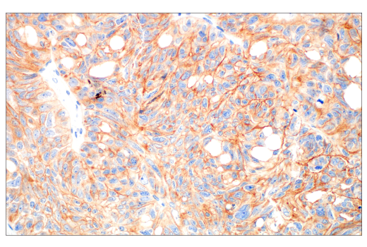 Immunohistochemistry Image 2: HER3/ErbB3 (D22C5) Rabbit Monoclonal Antibody