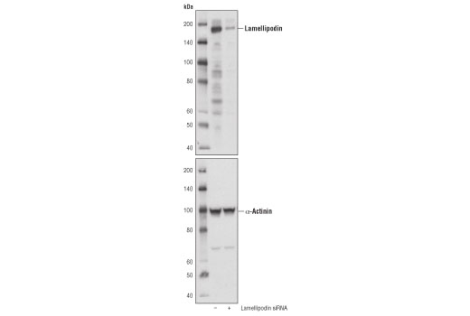 Western Blotting Image 2: Lamellipodin (D8A2K) Rabbit Monoclonal Antibody