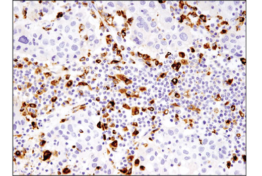 CD68 (D4B9C) XP® Rabbit mAb | Cell Signaling Technology