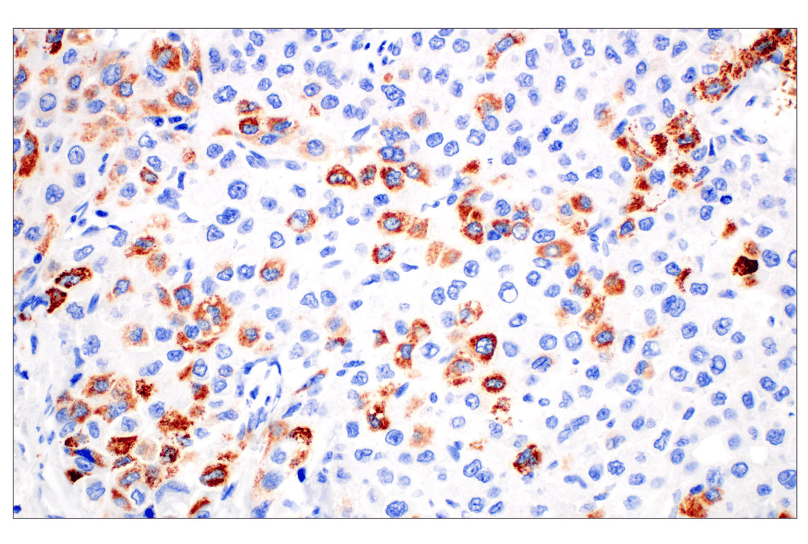 Immunohistochemistry Image 1: CPS1/Hep Par-1 (E9I9U) Rabbit Monoclonal Antibody (BSA and Azide Free)