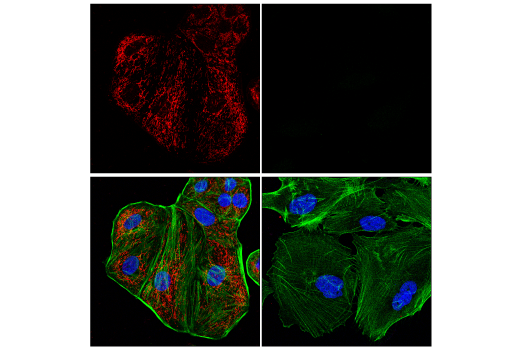 Immunofluorescence Image 1: MTHFD2 (E7A4L) XP<sup>®</sup> Rabbit mAb (Alexa Fluor<sup>®</sup> 594 Conjugate)