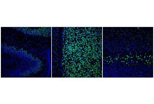 Immunofluorescence Image 1: Bcl-11B (D6F1) Rabbit Monoclonal Antibody (BSA and Azide Free)