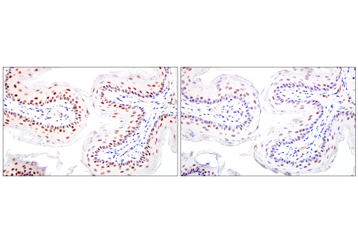 XRCC1 (E4A3V) XP® Rabbit mAb | Cell Signaling Technology