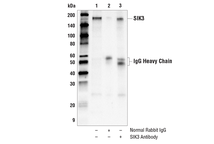Immunoprecipitation Image 1: SIK3 Antibody