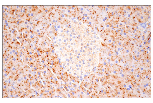 Immunohistochemistry Image 4: Cathepsin D (E7Z4L) XP<sup>®</sup> Rabbit mAb (BSA and Azide Free)