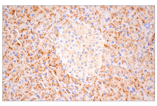 Immunohistochemistry Image 4: Cathepsin D (E7Z4L) Rabbit Monoclonal Antibody (BSA and Azide Free)