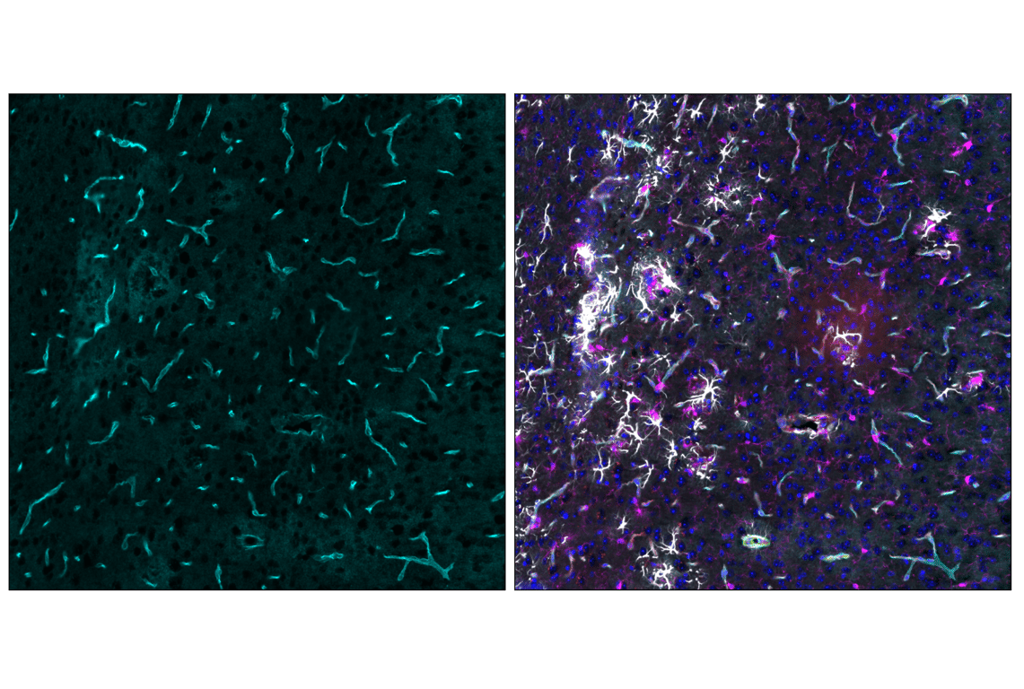 Immunofluorescence Image 6: AQP4 (D1F8E) Rabbit Monoclonal Antibody (Alexa Fluor<sup>®</sup> 647 Conjugate)