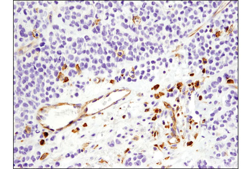 Immunohistochemistry Image 3: VISTA (D1L2G<sup>™</sup>) Rabbit Monoclonal Antibody (BSA and Azide Free)