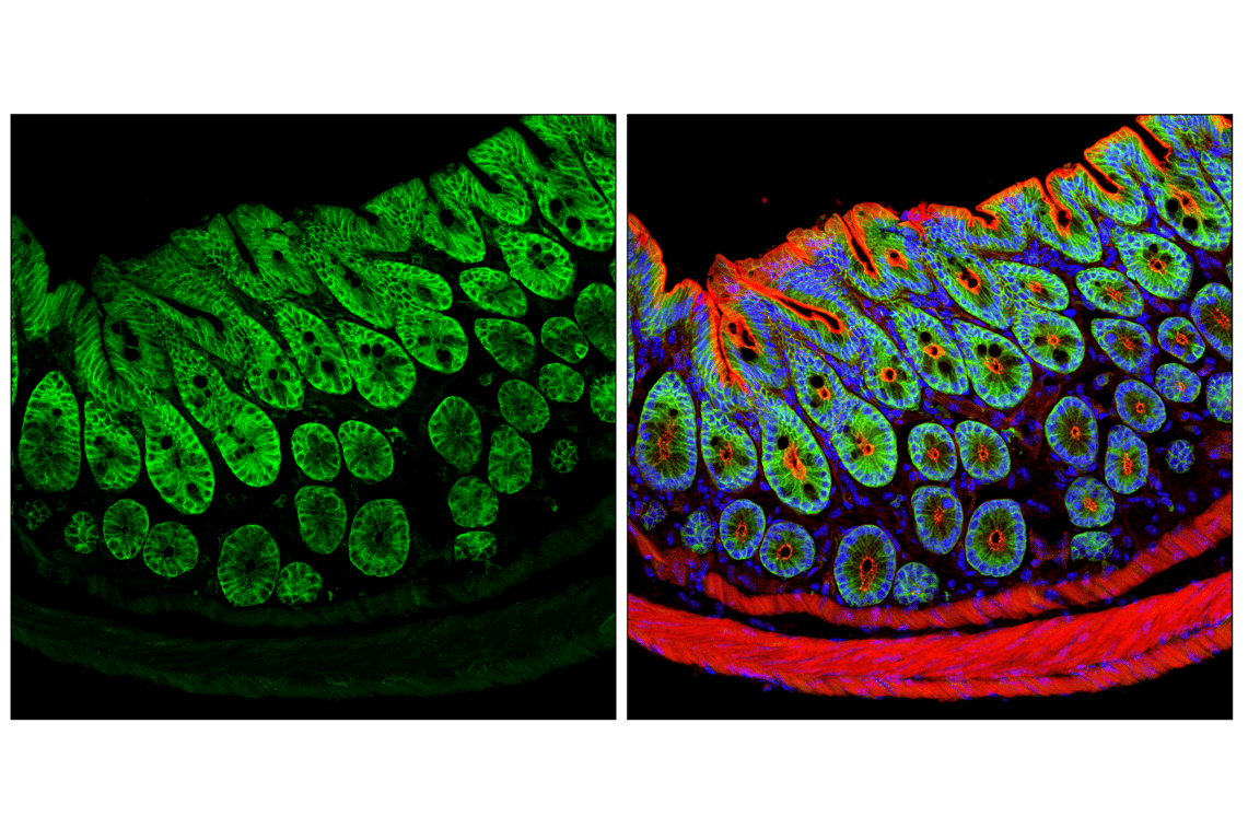 undefined Image 21: Actin Reorganization Antibody Sampler Kit