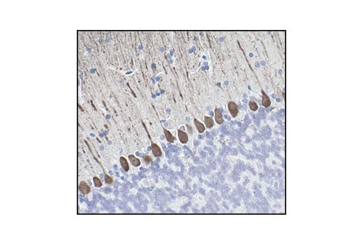 Immunohistochemistry Image 1: Calbindin Antibody