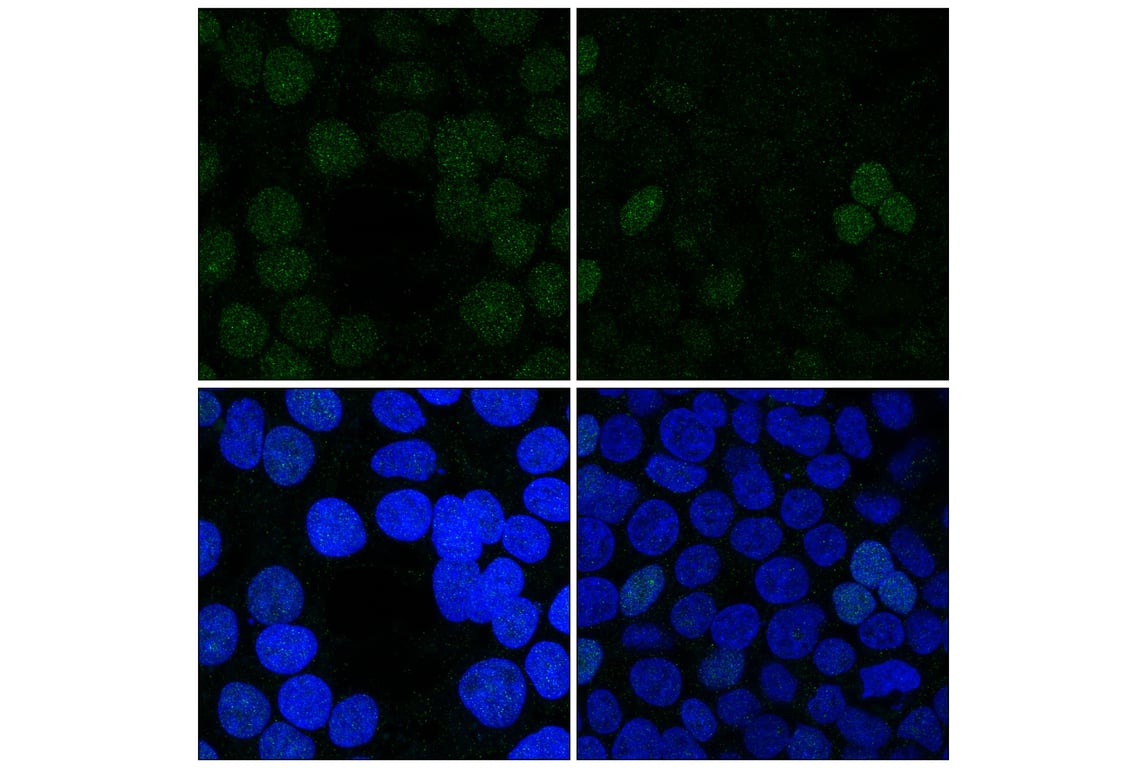 Immunofluorescence Image 2: MLLT3 (E5Z7U) Rabbit Monoclonal Antibody