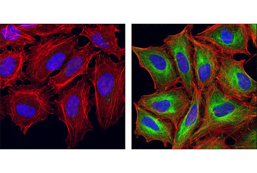 Immunofluorescence Image 2: Acetyl-alpha-Tubulin (Lys40) (D20G3) Rabbit Monoclonal Antibody