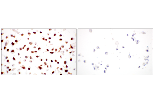 undefined Image 41: ATM Substrates Antibody Sampler Kit