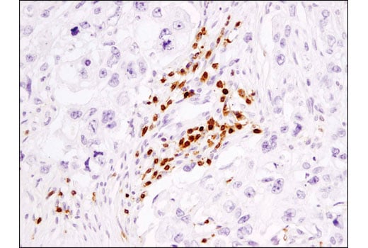undefined Image 41: Human Exhausted CD8<sup>+</sup> T Cell IHC Antibody Sampler Kit