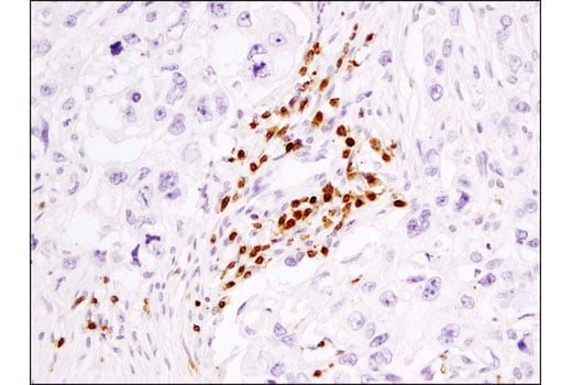 Immunohistochemistry Image 2: CD3ε (D7A6E<sup>™</sup>) XP<sup>®</sup> Rabbit mAb