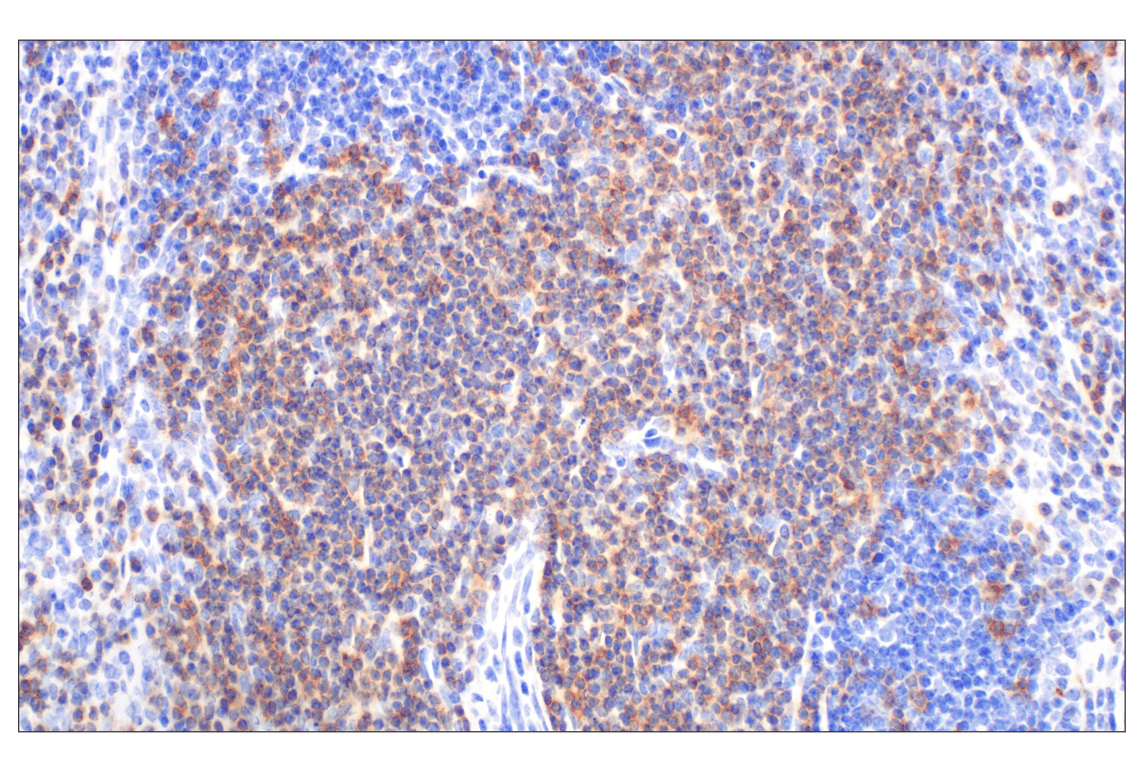 Immunohistochemistry Image 3: CD27 (F3R2V) Rabbit Monoclonal Antibody