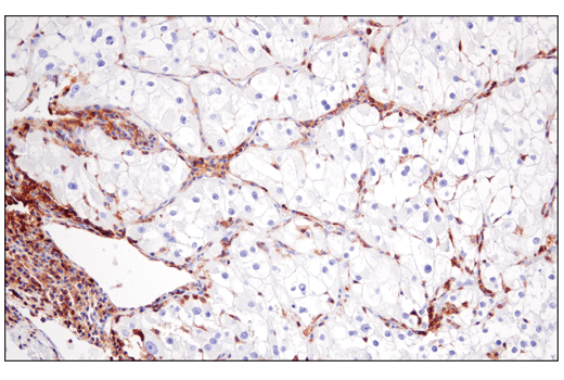 Immunohistochemistry Image 2: CD48 (D7L8I) Rabbit Monoclonal Antibody (BSA and Azide Free)