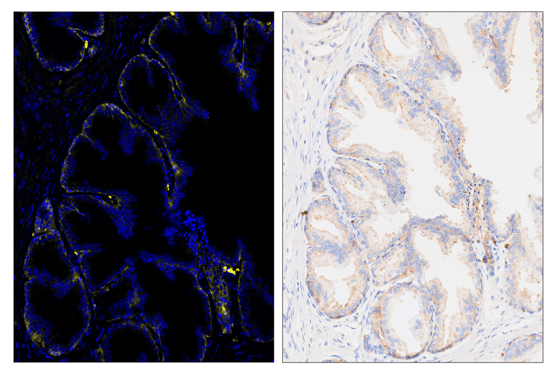 Immunohistochemistry Image 3: Glut1 (E4S6I) & CO-0192-647 SignalStar<sup>®</sup> Oligo-Antibody Pair