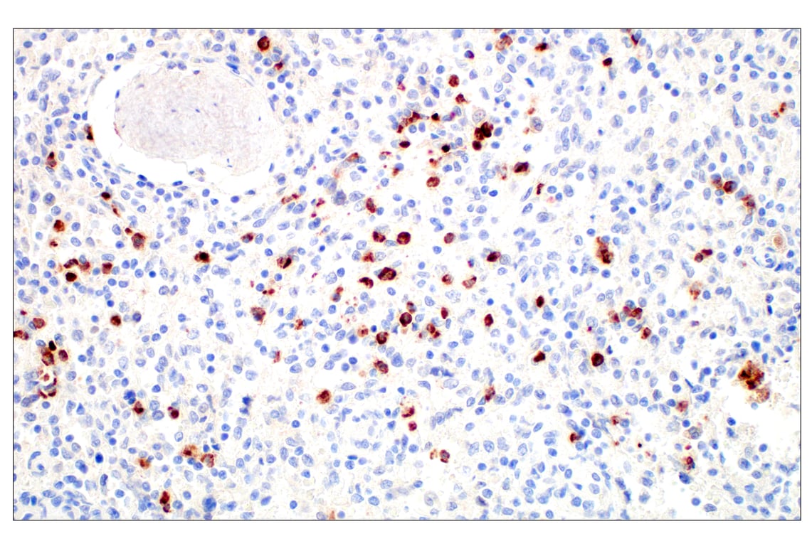 Immunohistochemistry Image 1: OLR1/LOX1 (E9C5A) Rabbit Monoclonal Antibody (BSA and Azide Free)