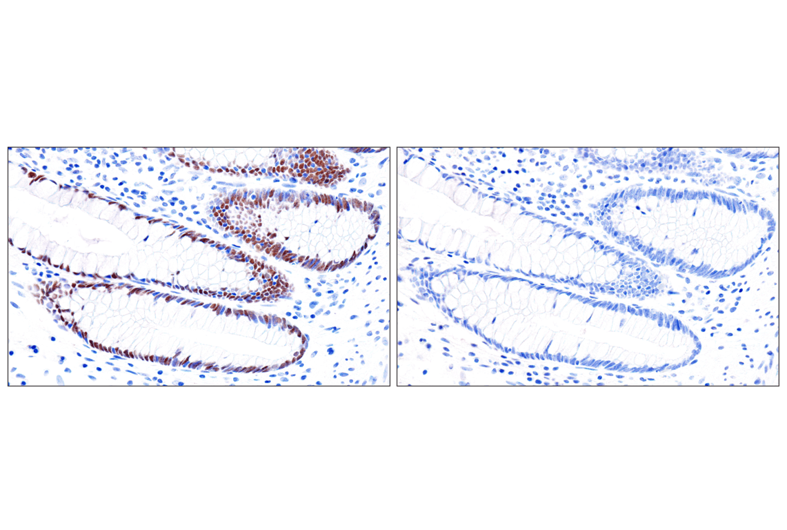 Immunohistochemistry Image 23: GATA-6 (D61E4) Rabbit Monoclonal Antibody