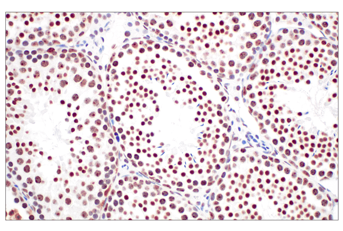 Immunohistochemistry Image 9: NPM1 (E7W4P) Rabbit Monoclonal Antibody (BSA and Azide Free)