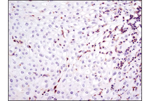 Immunohistochemistry Image 1: LCP1 (D1C3) Rabbit Monoclonal Antibody