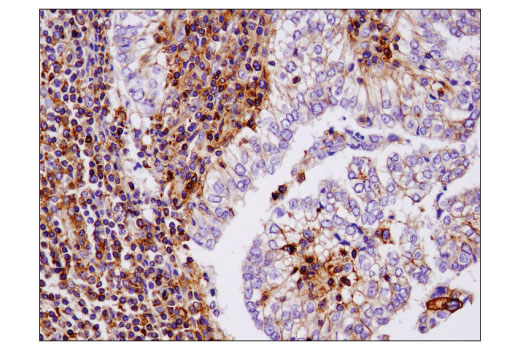 Immunohistochemistry Image 1: IQGAP1 (D8K4X) Rabbit Monoclonal Antibody