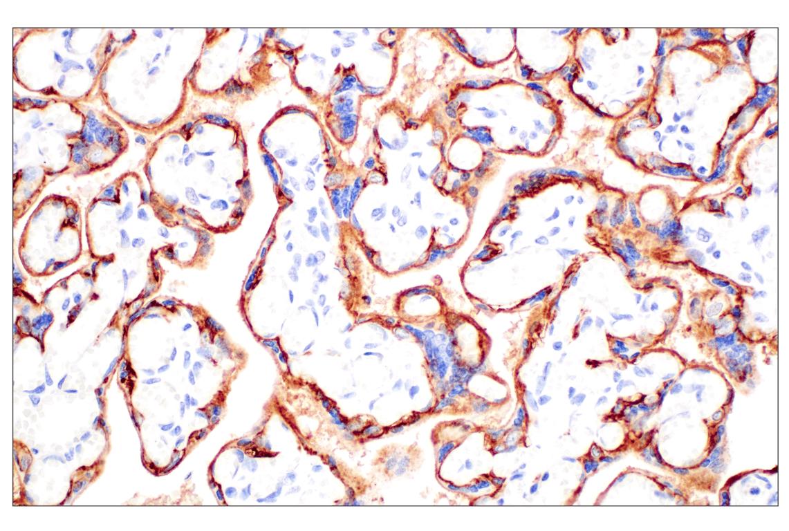 Immunohistochemistry Image 7: TACSTD2/TROP2 (F4W4J) Rabbit Monoclonal Antibody