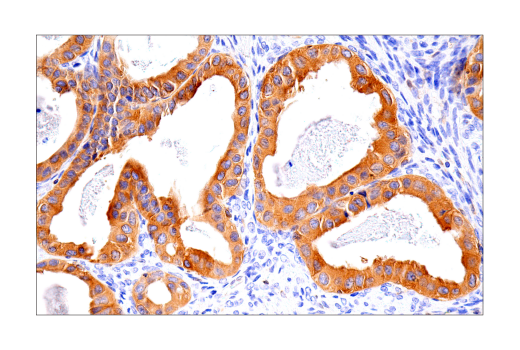 Immunohistochemistry Image 8: RIP3 (E7A7F) Rabbit Monoclonal Antibody