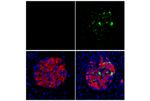 ranaページ✨️ Cre Recombinase (D7L7L) XP® Rabbit mAb (Alexa Fluor® 647