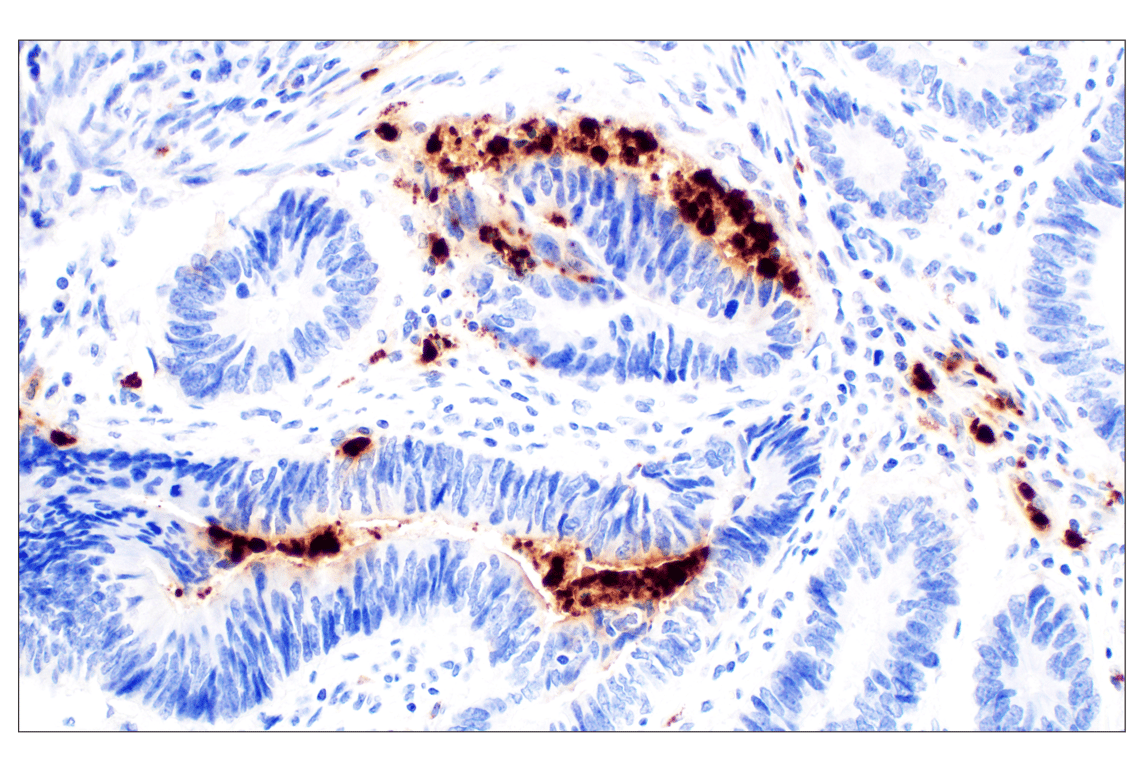 Immunohistochemistry Image 1: Neutrophil Elastase (F4H3X) Rabbit Monoclonal Antibody (BSA and Azide Free)