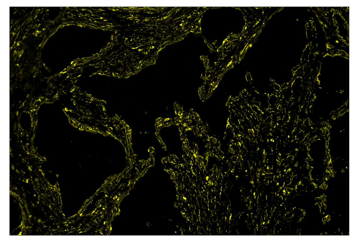 Immunohistochemistry Image 3: alpha-Smooth Muscle Actin (D4K9N) & CO-0024-488 SignalStar<sup>™</sup> Oligo-Antibody Pair