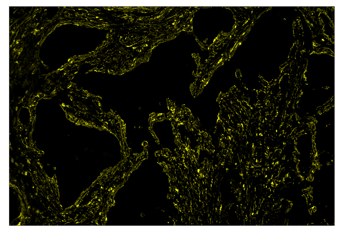 Immunohistochemistry Image 3: α-Smooth Muscle Actin (D4K9N) & CO-0024-594 SignalStar<sup>™</sup> Oligo-Antibody Pair