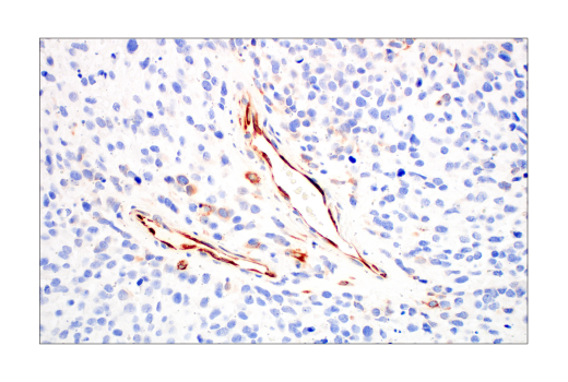 Immunohistochemistry Image 1: CYR61 (E5W3H) Rabbit Monoclonal Antibody