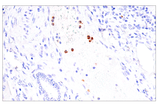 Immunohistochemistry Image 4: CEACAM6 (E7S7Y) Rabbit Monoclonal Antibody (BSA and Azide Free)