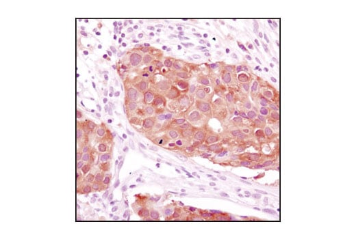 Immunohistochemistry Image 1: NME1/NDKA (D98) Antibody