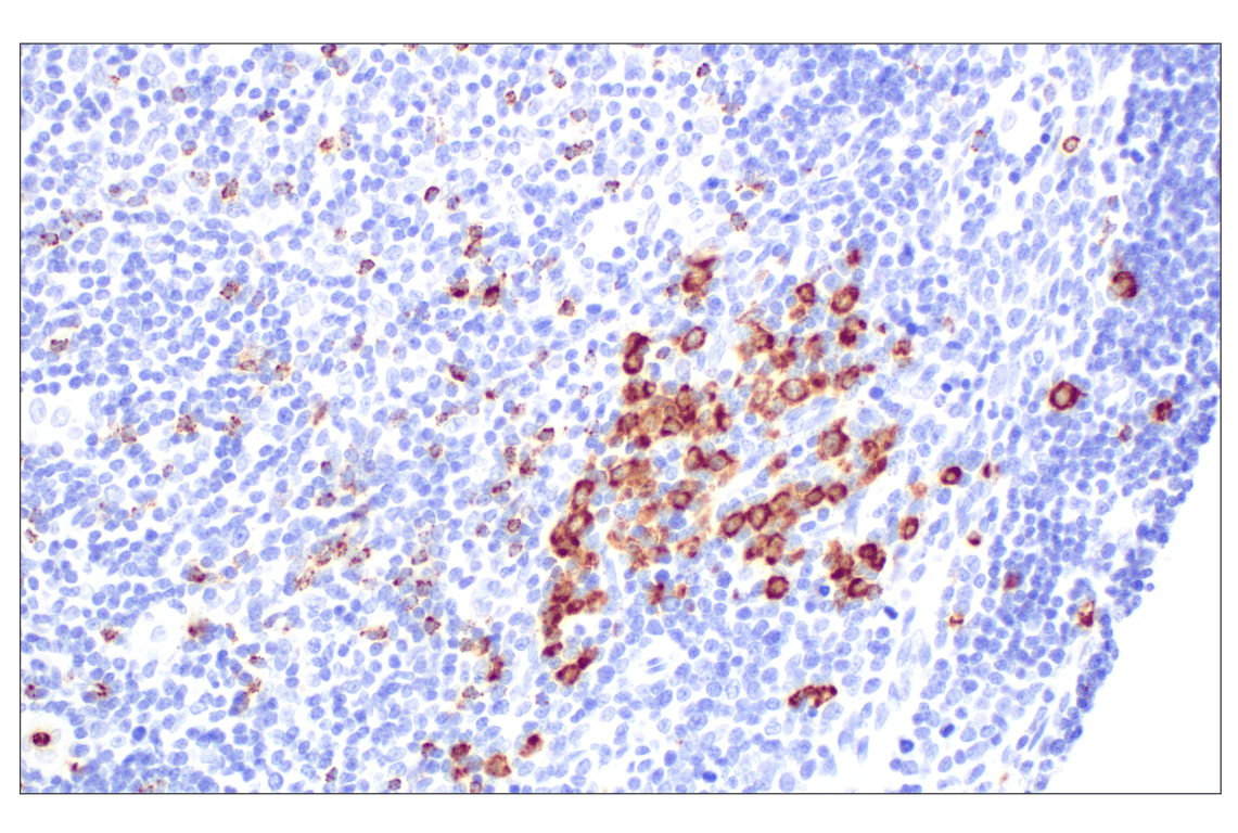 Immunohistochemistry Image 9: NKG7 (F4V5I) Rabbit Monoclonal Antibody