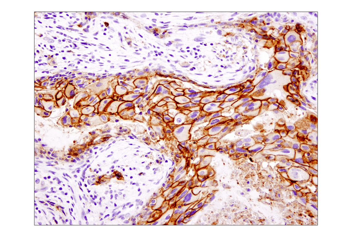 Immunohistochemistry Image 1: EpCAM (D9S3P) Rabbit Monoclonal Antibody