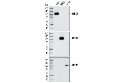 Western Blotting Image 1: RSK3 Antibody