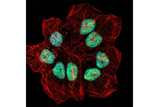 Immunofluorescence Image 1: RING1B (D22F2) Rabbit Monoclonal Antibody