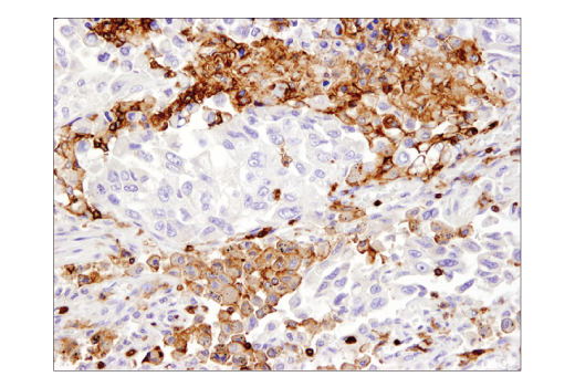 Immunohistochemistry Image 1: CD45 (Intracellular Domain) (D9M8I) Rabbit Monoclonal Antibody (BSA and Azide Free)