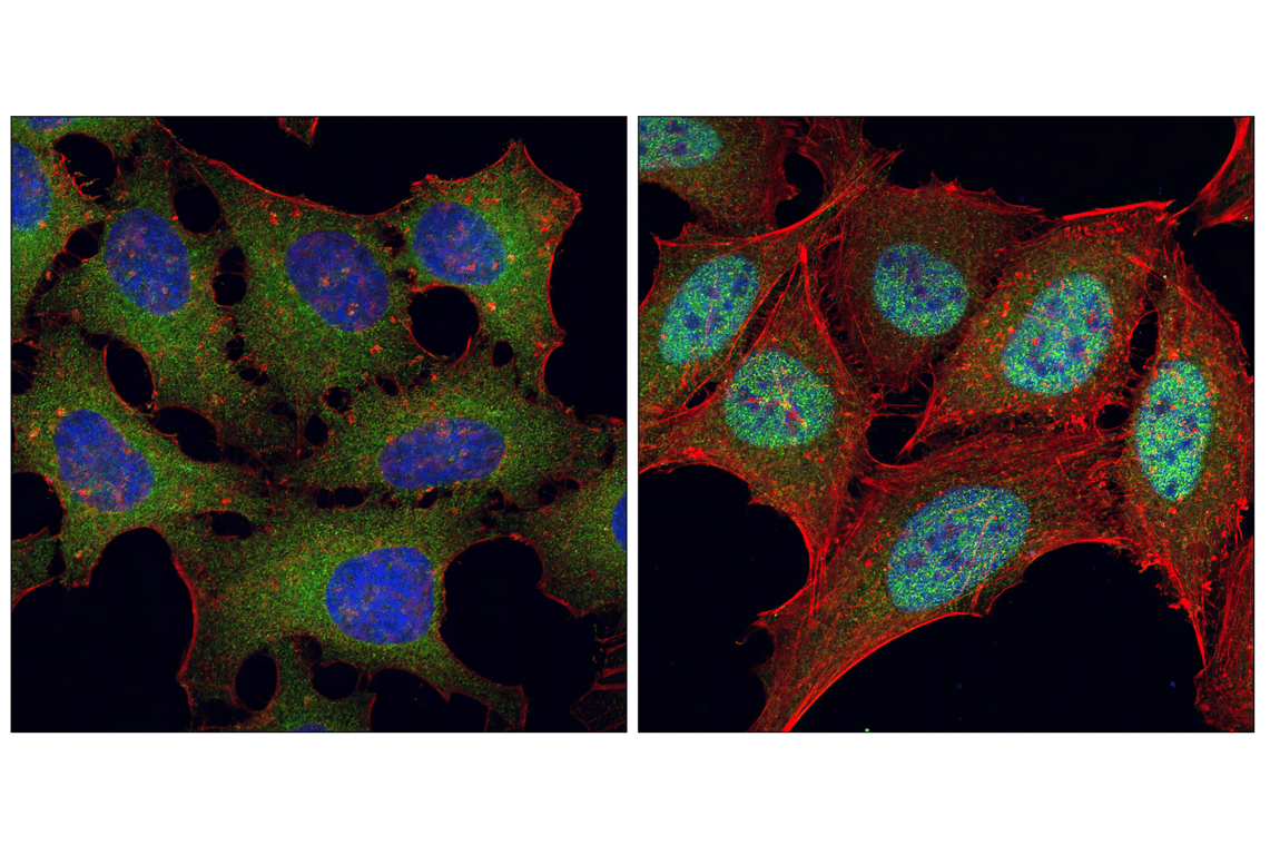 Immunofluorescence Image 1: NF-kappaB p65 (C22B4) Rabbit Monoclonal Antibody (BSA and Azide Free)
