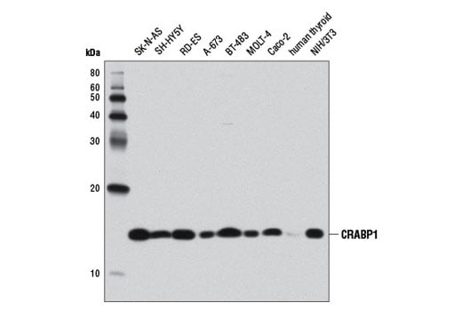 Western Blotting Image 3: CRABP1 (D7F9T) Rabbit Monoclonal Antibody