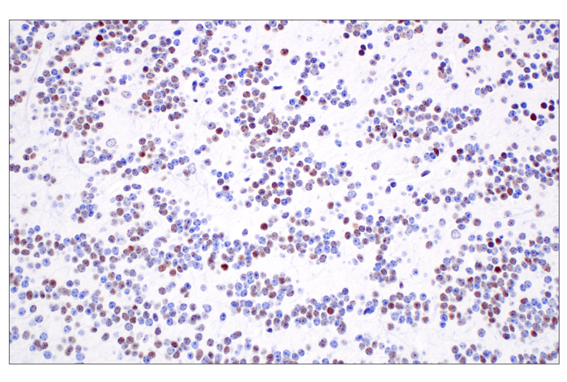 Immunohistochemistry Image 6: TCF4/ITF2 (E3X2Y) Rabbit Monoclonal Antibody