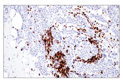 Immunohistochemistry Image 1: CD6 (E9Y7Y) Rabbit Monoclonal Antibody