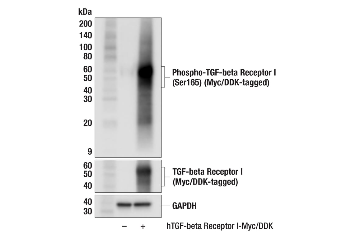 Western Blotting Image 3: Phospho-TGF-beta Receptor I (Ser165) (F5E2G) Rabbit Monoclonal Antibody