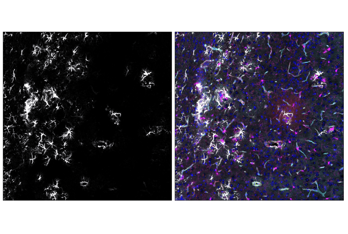 Immunofluorescence Image 2: GFAP (E4L7M) Rabbit Monoclonal Antibody (Alexa Fluor<sup>®</sup> 488 Conjugate)