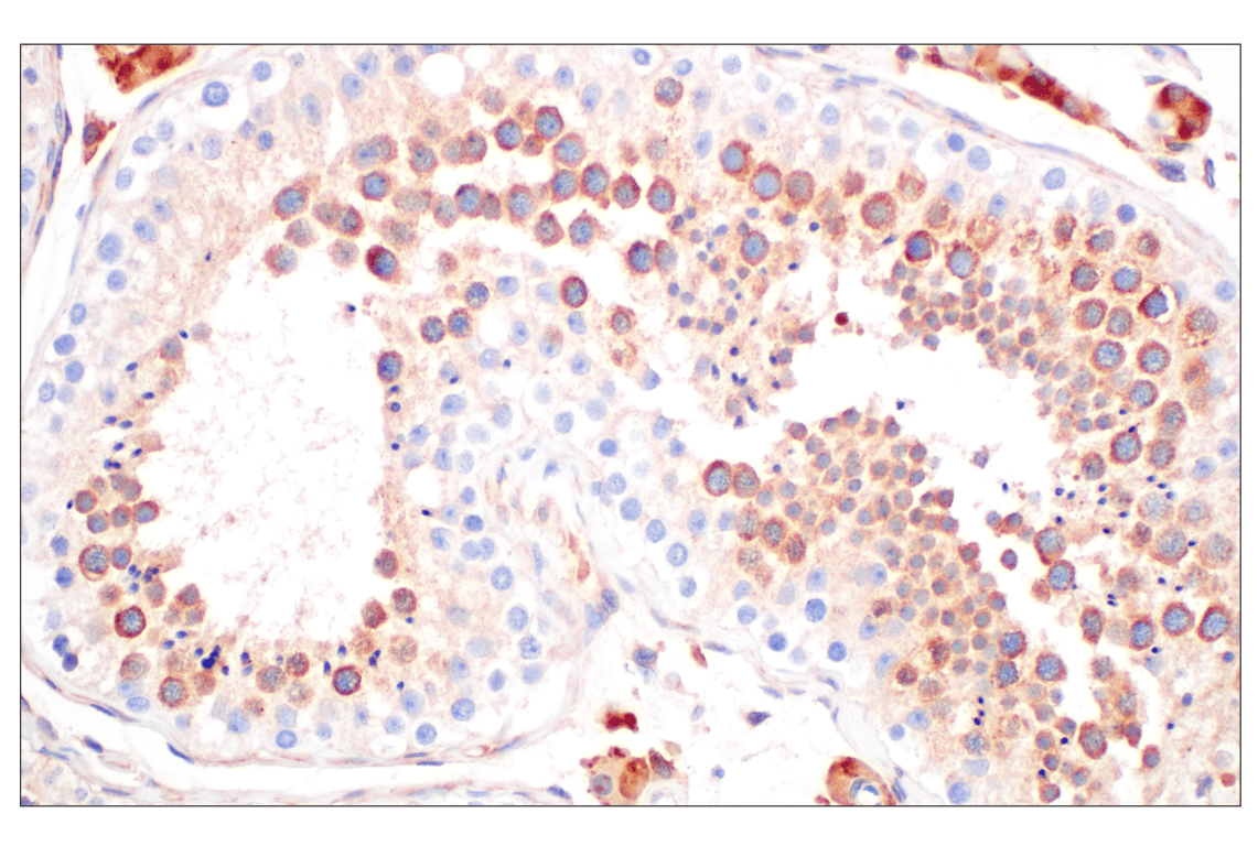 Immunohistochemistry Image 7: EEA1 (E9Q6G) Mouse Monoclonal Antibody