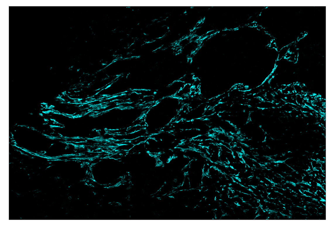Immunohistochemistry Image 5: FAP (F1A4G) & CO-0116-594 SignalStar<sup>™</sup> Oligo-Antibody Pair